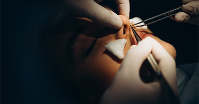 مميزات وعيوب تجميل الأنف بالليزر، الفرق بينه وبين الجراحة التقليدية